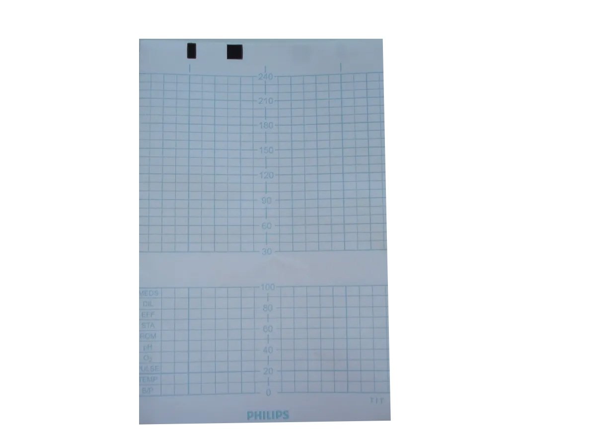Papel Termossensível para ECG TITS 150mmx100mx150 Folhas Tecnoprint para HP Avalon